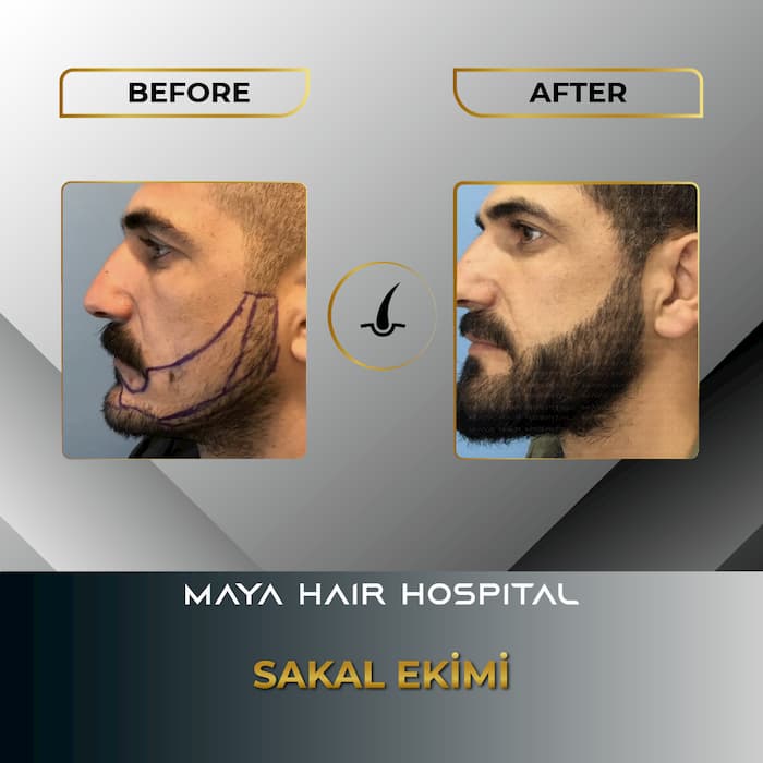 Maya Hair Hospital